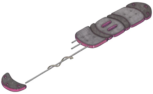 Image showing insertion of metal rods